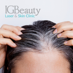Why Mesotherapy is a Beneficial Treatment for Hair Loss