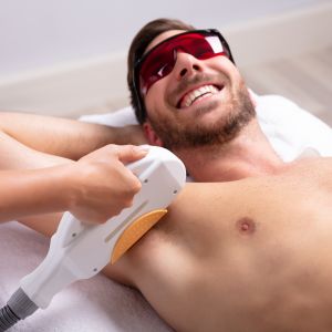 Why Men in Toronto Are Choosing Laser Hair Removal Services Over Shaving