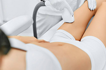 laser hair removal services