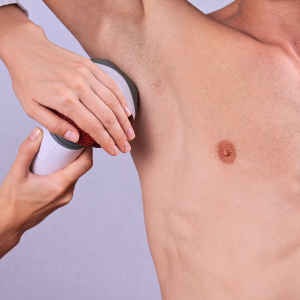 Men's Guide to Laser Hair Removal