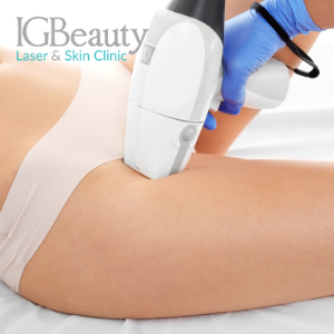 Sugaring vs Brazilian Laser Hair Removal in Toronto