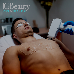 Why Eliminate Chest Hair with Laser Hair Removal for Men