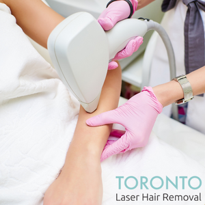 Why Skip At-Home Laser Hair-Removal in Toronto for Best Results