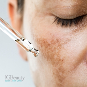 How to Combat Hyperpigmentation at Your Local Skin Care Clinic