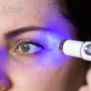 Myths About Laser Scar Removal