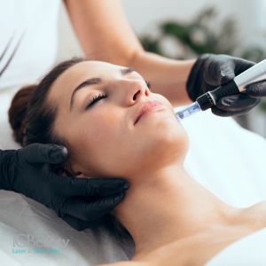 Microneedling vs. Other Skin Treatments