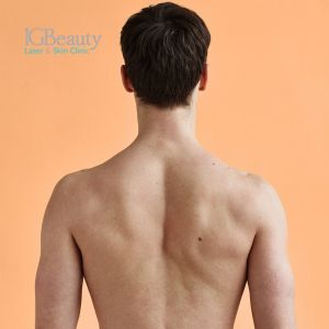 Can You Get Laser Hair Removal with Skin Conditions Like Eczema