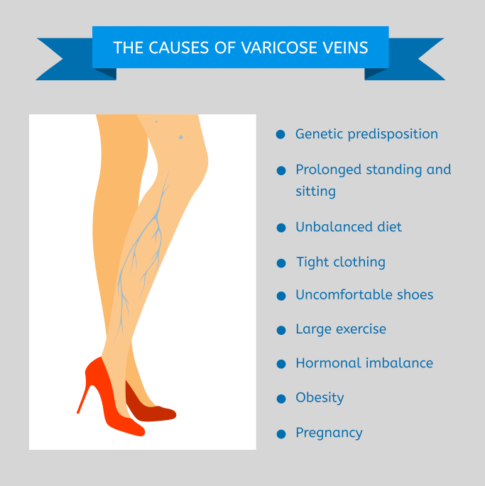 Varicose Vein Laser & IPL Vascular Treatment Toronto