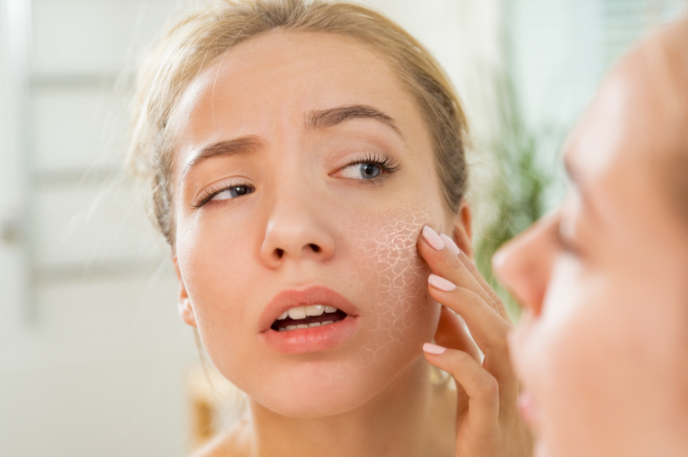 girl woman beauty toronto igbeauty skin skincare sun damaged