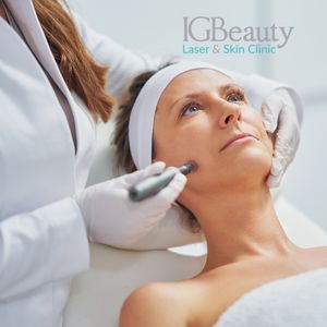 microneedling Toronto