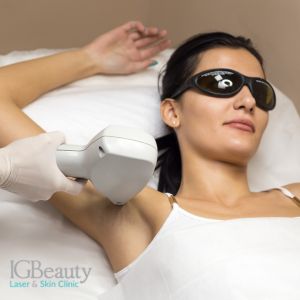 Brazilian laser hair removal