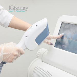laser hair removal machines
