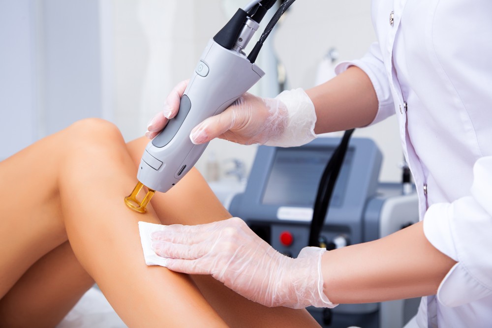 laser hair removal treatment in Toronto