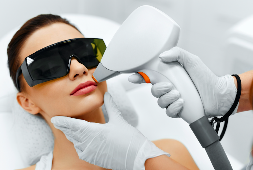 laser hair removal for facial hair