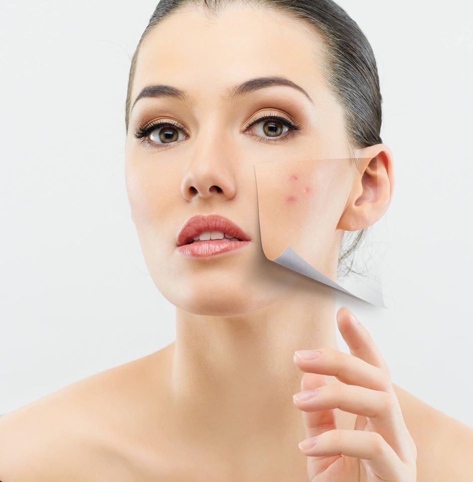 dermaroller home care system skin rejuvination blemishes scars