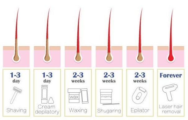 Hair Removal Methods