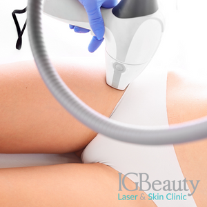 Brazilian laser hair removal