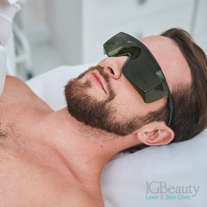 laser hair removal for men