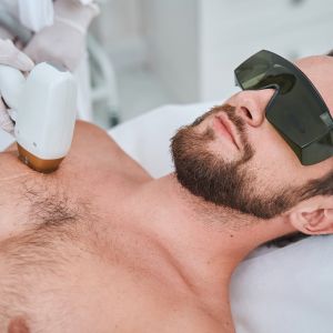 Laser hair removal for men