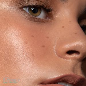 laser hair removal for the face