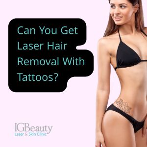 laser hair removal over tattoos