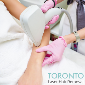 laser hair removal toronto